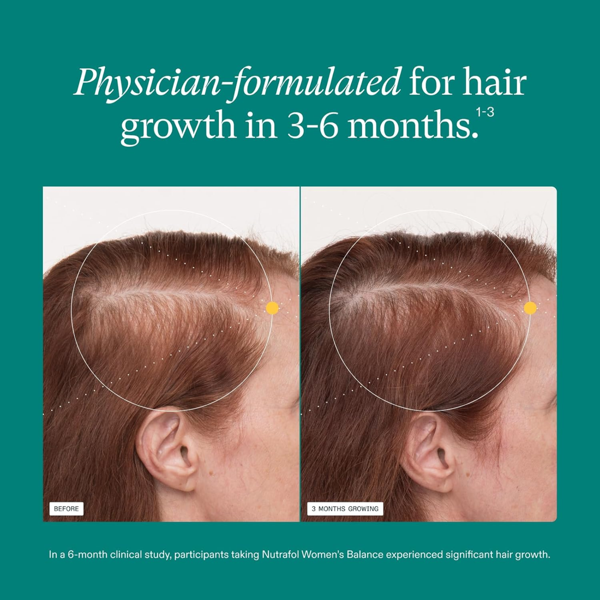 Nutrafol Women's Balance Hair Growth Nutraceutical Refill | 120 Capsules